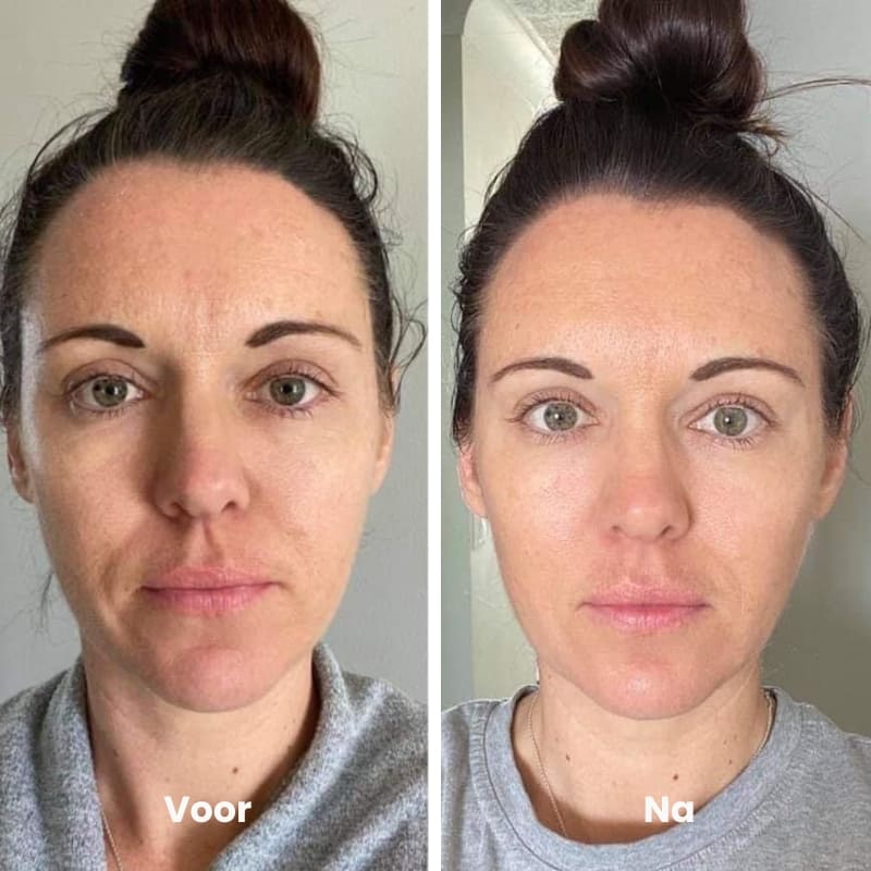 voor en na 3