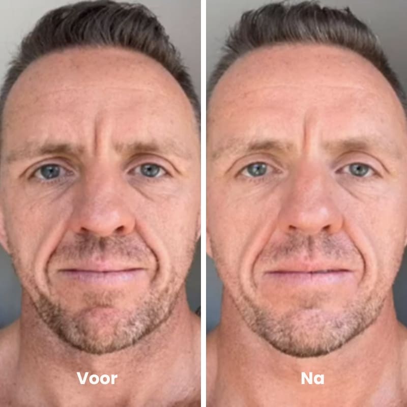 voor en na 4